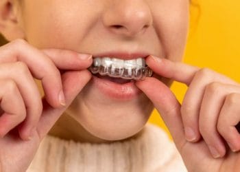 braces