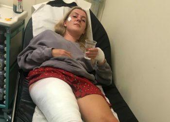 Leone Cook, 18, suffered the injuries on the last day of Reading Festival Picture: Leone Cook