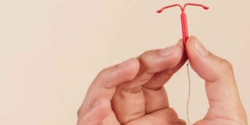 The new service that offers free access to long-term contraception methods. Pic: WBC.