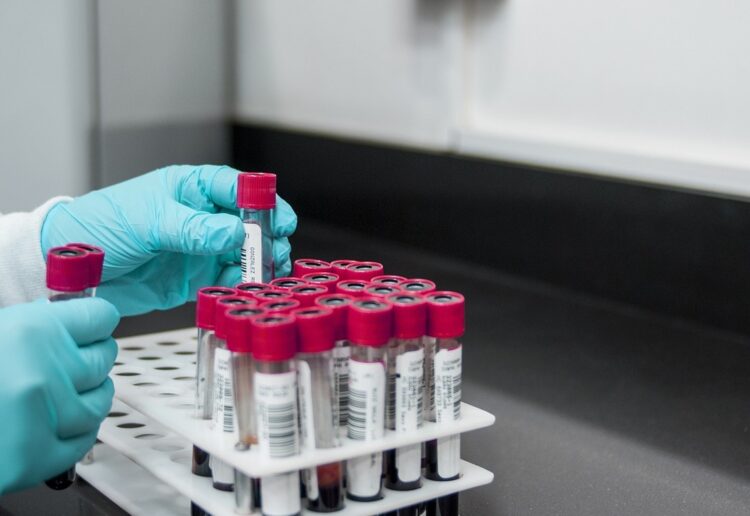 A STUDY is aiming to redress underrepresentation of Asian communities in health research and seeking participants from Berkshire. Picture: Fernando Zhiminaicela via Pixabay