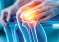 A new study, led by King's College, London, shows the strongest genetic evidence yet that fibromyalgia is linked to the nervous system. Picture: Tung Lam via Pixabay