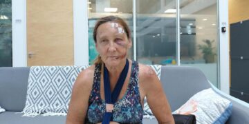 Elaine Parry, a mum in her 60s, was cycling when she was hit by an e-scooter rider at the A33 junction with Rose Kiln Lane in Reading on August 2. Credit: James Aldridge, Local Democracy Reporting Service